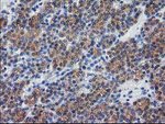 DSTN Antibody in Immunohistochemistry (Paraffin) (IHC (P))