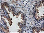 DSTN Antibody in Immunohistochemistry (Paraffin) (IHC (P))