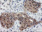 DSTN Antibody in Immunohistochemistry (Paraffin) (IHC (P))