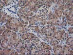 DSTN Antibody in Immunohistochemistry (Paraffin) (IHC (P))