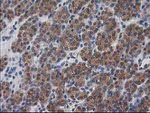 DSTN Antibody in Immunohistochemistry (Paraffin) (IHC (P))