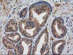 DSTN Antibody in Immunohistochemistry (Paraffin) (IHC (P))