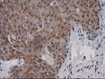 DSTN Antibody in Immunohistochemistry (Paraffin) (IHC (P))