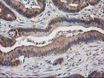 DSTN Antibody in Immunohistochemistry (Paraffin) (IHC (P))