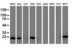 DSTN Antibody in Western Blot (WB)