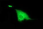 DTD1 Antibody in Immunocytochemistry (ICC/IF)