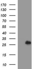 DTD1 Antibody in Western Blot (WB)