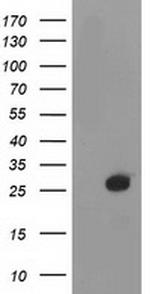 DTYMK Antibody in Western Blot (WB)