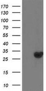 DTYMK Antibody in Western Blot (WB)