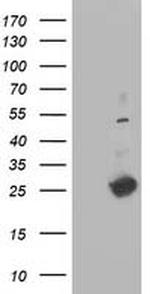 DTYMK Antibody in Western Blot (WB)