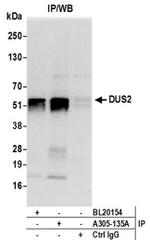 DUS2/DUS2L Antibody in Western Blot (WB)