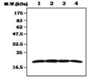 DUSP3 Antibody in Western Blot (WB)