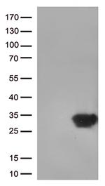 DUSP3 Antibody in Western Blot (WB)