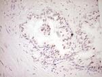 DVL2 Antibody in Immunohistochemistry (Paraffin) (IHC (P))