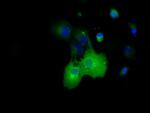DYNC1LI1 Antibody in Immunocytochemistry (ICC/IF)