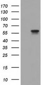 DYNC1LI1 Antibody in Western Blot (WB)