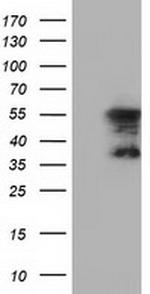 DYNC1LI1 Antibody in Western Blot (WB)