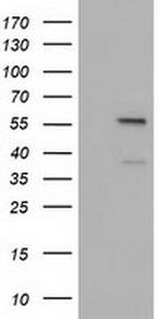 DYNC1LI1 Antibody in Western Blot (WB)