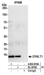 DYNLT1 Antibody in Western Blot (WB)