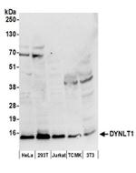 DYNLT1 Antibody in Western Blot (WB)