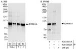 DYRK1A Antibody in Western Blot (WB)