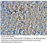 DYRK2 Antibody in Immunohistochemistry (IHC)