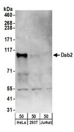 Dab2 Antibody in Western Blot (WB)