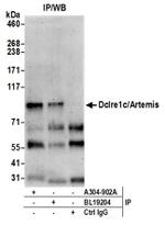 Dclre1c/Artemis Antibody in Western Blot (WB)