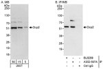 Dcp2 Antibody in Western Blot (WB)