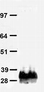 Dendra2 Antibody in Western Blot (WB)