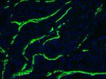 Desmin Antibody in Immunohistochemistry (Frozen) (IHC (F))