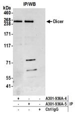 Dicer Antibody in Western Blot (WB)