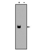 Digoxin Antibody in Western Blot (WB)