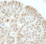 Drosha Antibody in Immunohistochemistry (IHC)