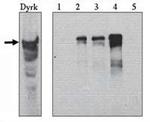 DYRK1A Antibody in Western Blot (WB)