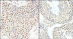 E1B-AP5 Antibody in Immunohistochemistry (IHC)