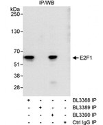 E2F1 Antibody in Immunoprecipitation (IP)