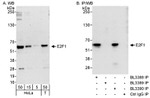 E2F1 Antibody in Western Blot (WB)