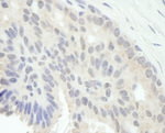 E2F1 Antibody in Immunohistochemistry (IHC)