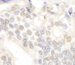 E2F4 Antibody in Immunohistochemistry (IHC)