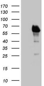 E2F4 Antibody in Western Blot (WB)