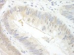 EAF2 Antibody in Immunohistochemistry (IHC)