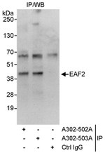 EAF2 Antibody in Immunoprecipitation (IP)