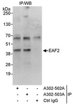 EAF2 Antibody in Immunoprecipitation (IP)