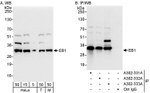 EB1 Antibody in Western Blot (WB)