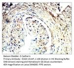 E-Cadherin Antibody in Immunohistochemistry (IHC)