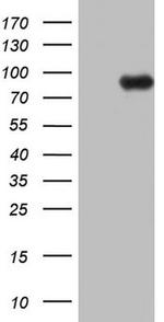 ECE1 Antibody in Western Blot (WB)