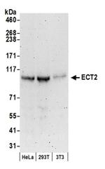 ECT2 Antibody in Western Blot (WB)