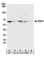 EDC3 Antibody in Western Blot (WB)