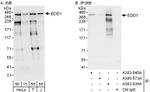 EDD1 Antibody in Western Blot (WB)